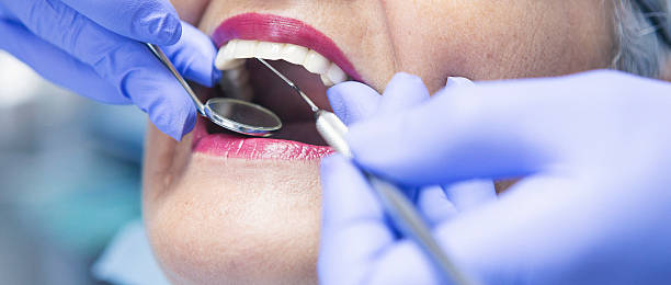 Best Emergency Dental Care for Broken or Chipped Teeth in Bradley Beach, NJ